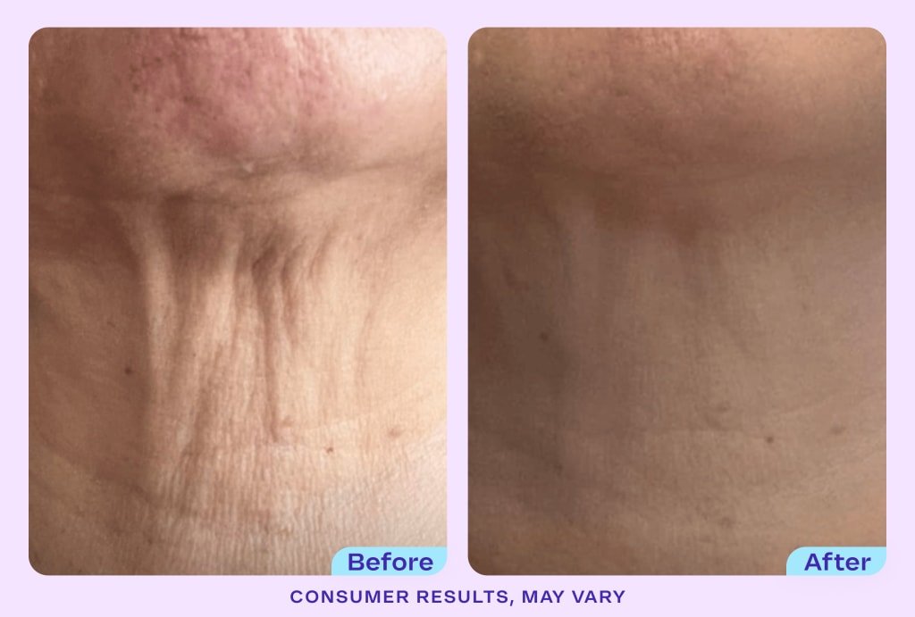 DermaLift™ - Tighten & Lift Neck Cream - Zentrob™