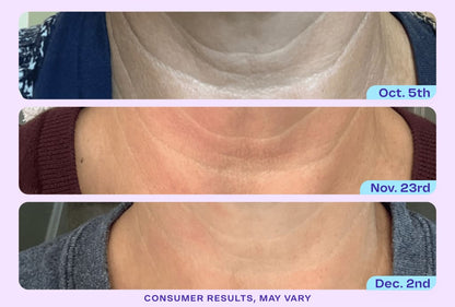 DermaLift™ - Tighten & Lift Neck Cream - Zentrob™