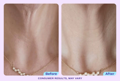 DermaLift™ - Tighten & Lift Neck Cream - Zentrob™
