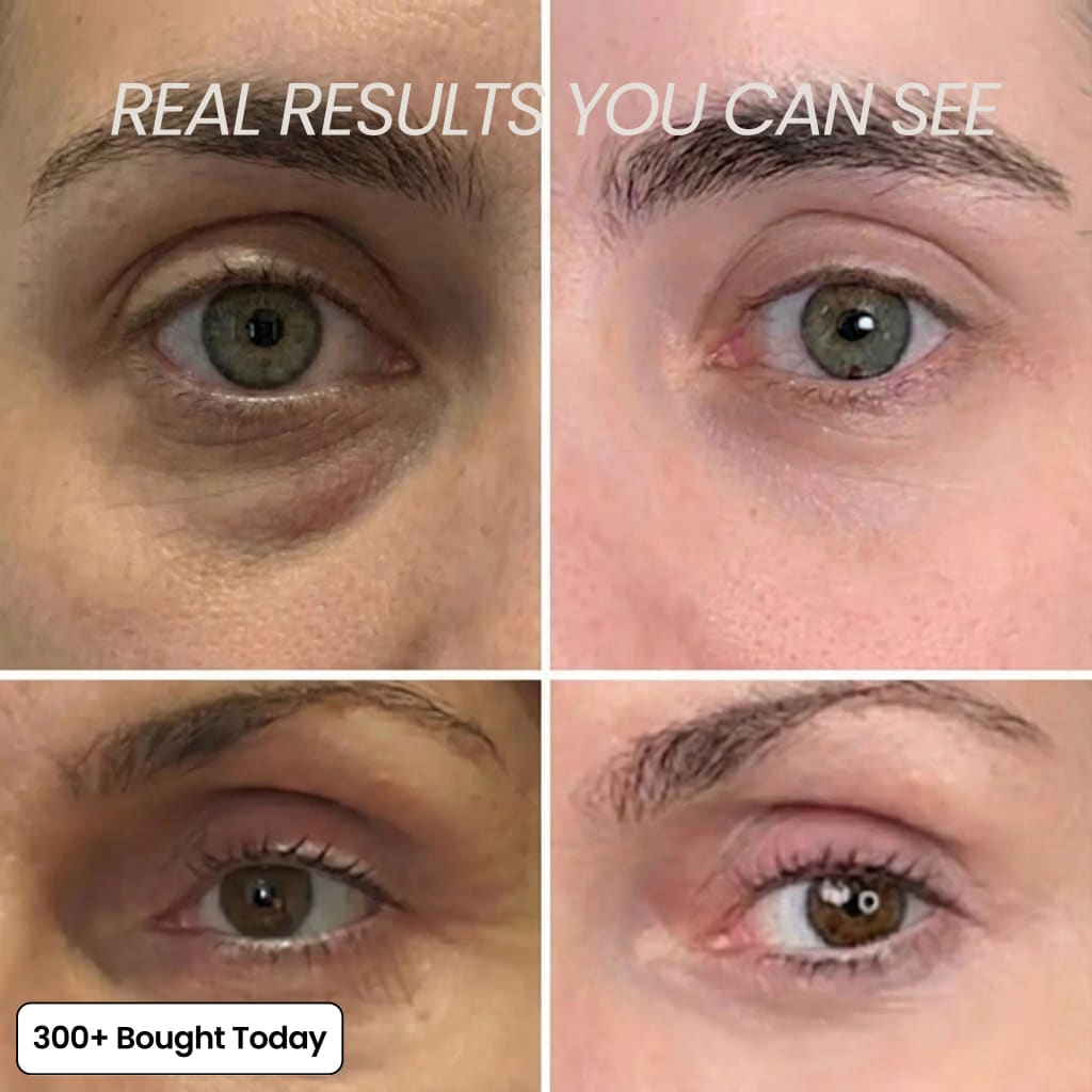 VitaLift™ Eye Revival Balm