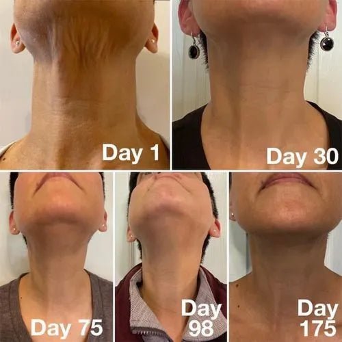 VitaLift™ Neck Firming Cream - VitaLift™